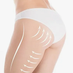 Seda Demir Beauty, Seda Demir, Tüm Vücut Lazer, 6 Bölge Lazer, 1 Bölge Lazer, Komple Ağda, Pop Lifting, Microblading, Kaş Kontürü, Kaş Gölgelendirme, Dudak Renklendirme, Dipliner, Kaş Silme, Saç Mezoterapisi, Porselen Makyaj, İpek Kirpik, Kirpik Lifting, Kaş Alımı, Jel Güçlendirme ve Kalıcı Oje, Protez Tırnak, Medikal Manikür, Medikal Pedikür, Manikür, Pedikür, Batık Tırnak Tedavisi